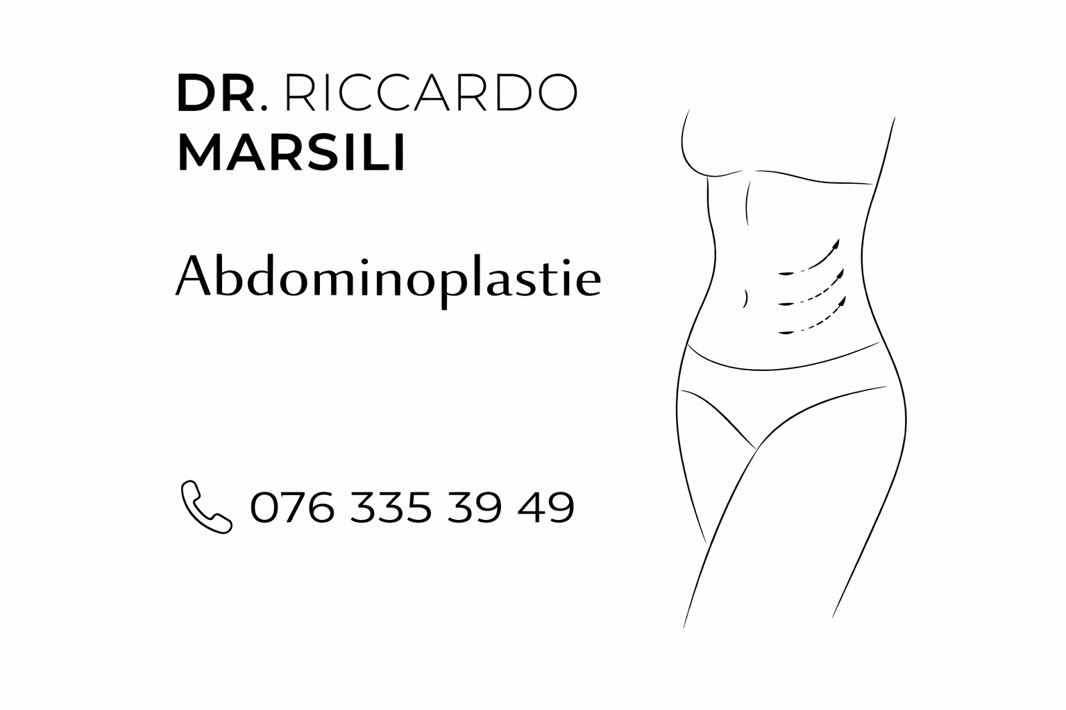 Abdominoplastie Lausanne Suisse
